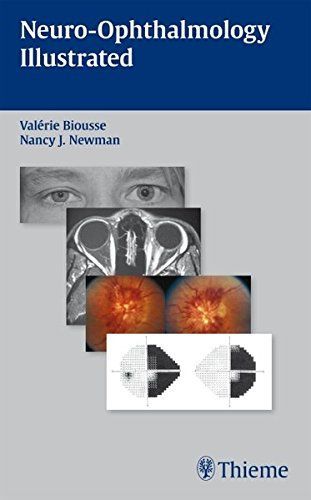 Neuro-Ophthalmology Illustrated