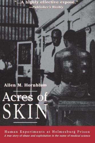 Acres of Skin