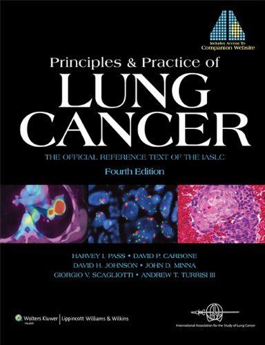 Principles and Practice of Lung Cancer