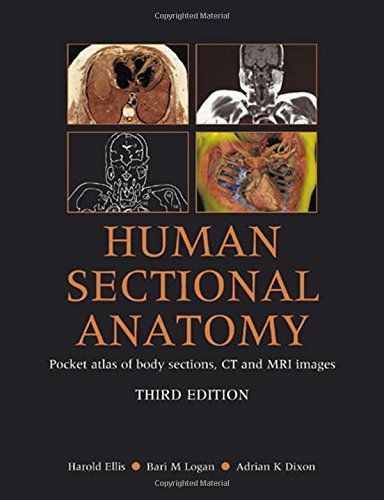 Human Sectional Anatomy