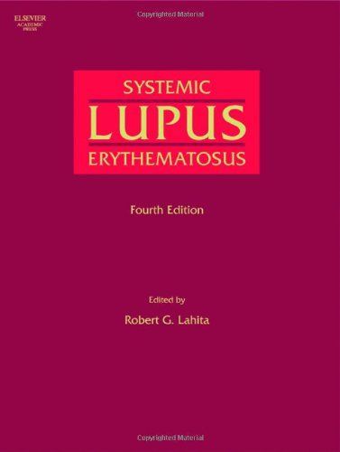 Systemic Lupus Erythematosus