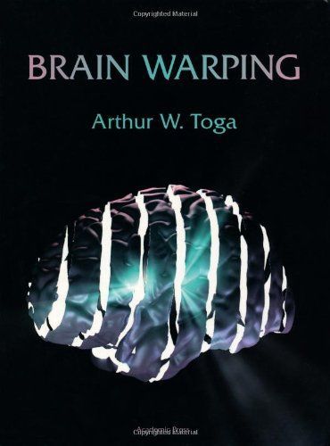 Brain Warping