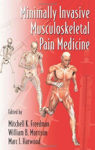 Minimally Invasive Musculoskeletal Pain Medicine