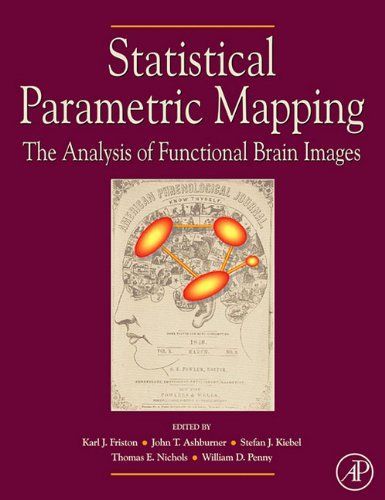 Statistical Parametric Mapping: The Analysis of Functional Brain Images