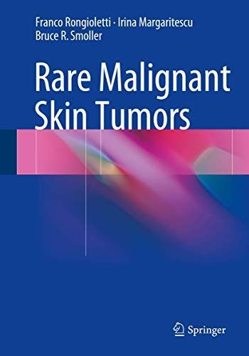 Rare Malignant Skin Tumors