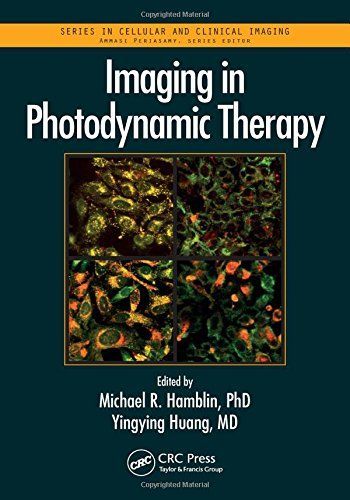 Imaging in Photodynamic Therapy