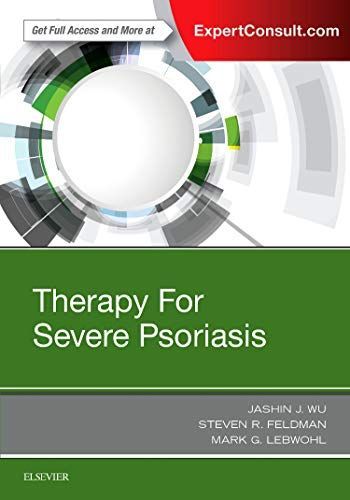 Therapy for Severe Psoriasis E-Book