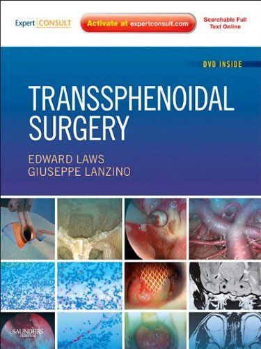 Transsphenoidal Surgery