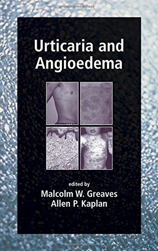 Urticaria and Angioedema