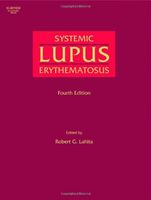 Systemic Lupus Erythematosus