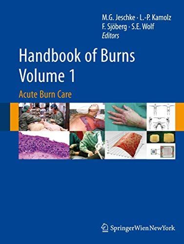 Handbook of Burns Volume 1