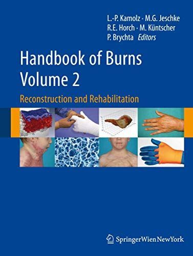 Handbook of Burns Volume 2