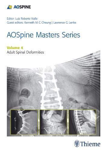 Aospine Masters Series, Volume 4: Adult Spinal Deformities