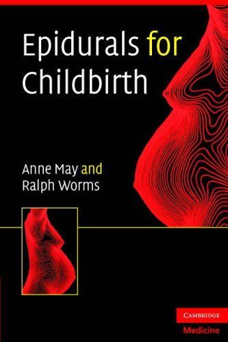 Epidurals for Childbirth