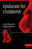 Epidurals for Childbirth