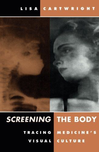 Screening the Body