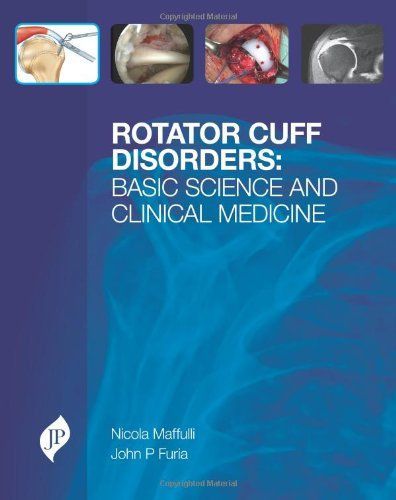 Rotator Cuff Disorders