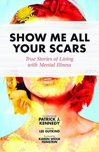 Show Me All Your Scars