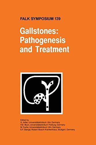 Gallstones