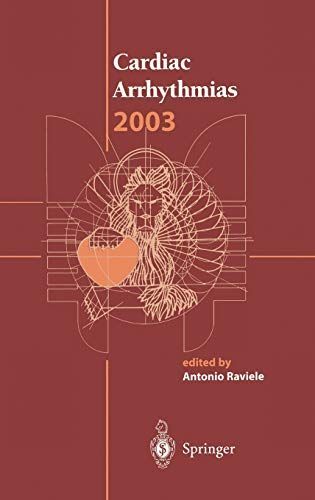 Cardiac Arrhythmias 2003