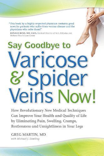 Say Goodbye to Varicose and Spider Veins Now!