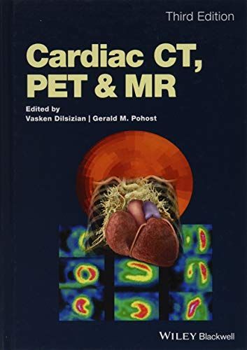 Cardiac CT, PET and MR