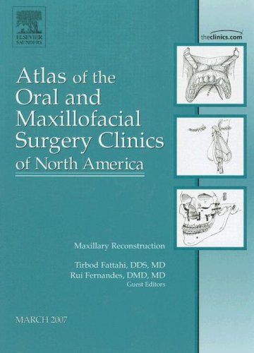 Maxillary Reconstruction