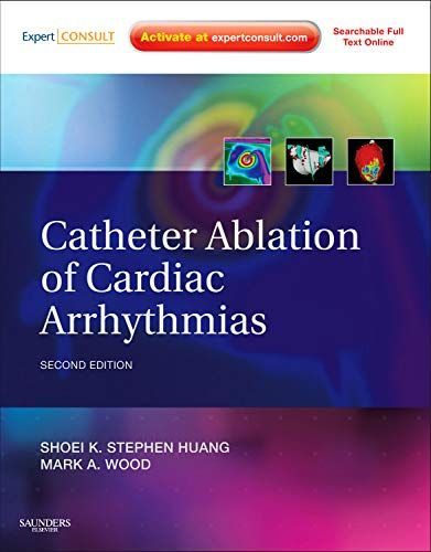 Catheter Ablation of Cardiac Arrhythmias