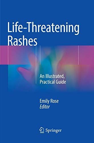 Life-Threatening Rashes