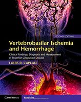 Vertebrobasilar Ischemia and Hemorrhage