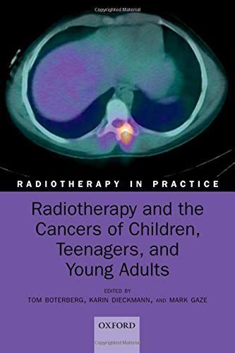 Radiotherapy and the Cancers of Children, Teenagers and Young Ads