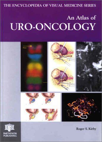 An Atlas of Uro-oncology