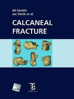 Calcaneal Fracture