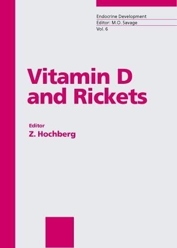 Vitamin D and Rickets