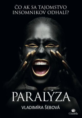 Paralýza