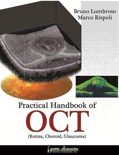Practical Handbook of OCT