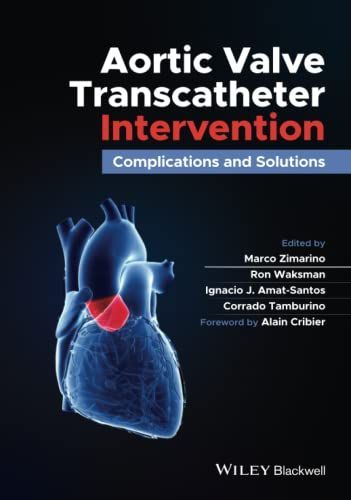 Aortic Valve Transcatheter Intervention