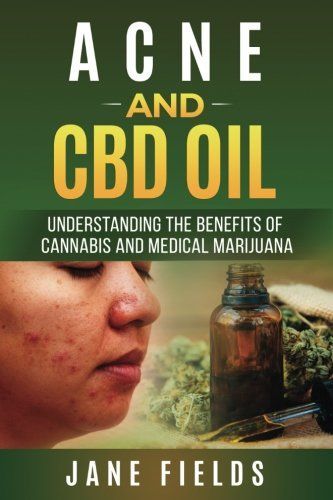 Acne and Cbd Oil Understanding the Benefits of Cannabis and Medical Marijuana