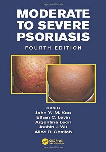 Moderate to Severe Psoriasis, Fourth Edition