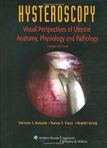 Hysteroscopy