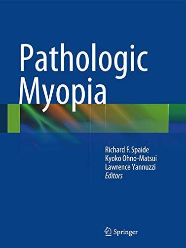 Pathologic Myopia