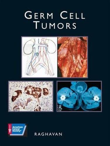 Germ Cell Tumors