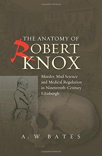The anatomy of Robert Knox