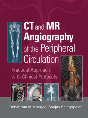 CT and MR Angiography of the Peripheral Circulation