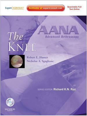 AANA Advanced Arthroscopy: The Knee E-Book