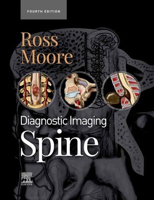 Diagnostic Imaging: Spine - E-Book