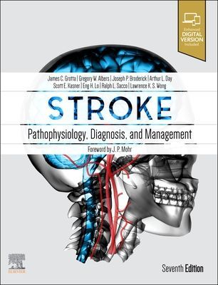 Stroke E-Book