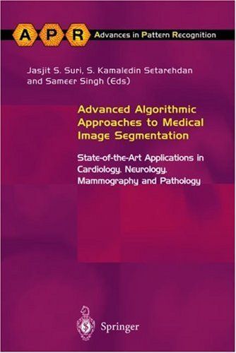 Advanced Algorithmic Approaches to Medical Image Segmentation