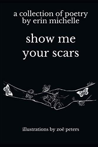 Show Me Your Scars