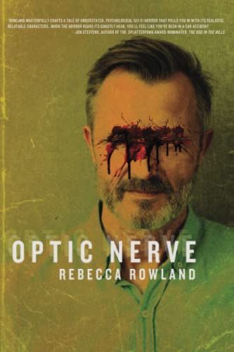 Optic Nerve